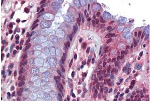Human Colon: Formalin-Fixed, Paraffin-Embedded (FFPE) (SRSF4 antibody  (AA 359-408))