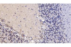 Detection of SHH in Human Cerebellum Tissue using Monoclonal Antibody to Hedgehog Homolog, Sonic (SHH) (Sonic Hedgehog antibody  (AA 36-193))