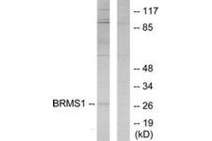 Western blot analysis of extracts from 293 cells, using BRMS1 Antibody. (BRMS1 antibody  (AA 21-70))