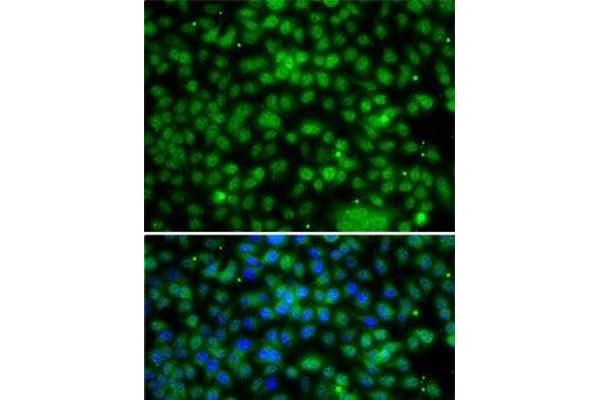 PHYHD1 antibody