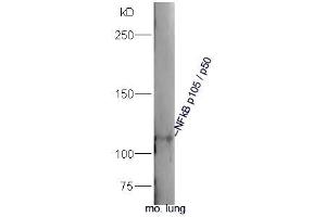 Mouse lung lysates probed with Rabbit Anti-NFkB p105/p50 Polyclonal Antibody, Unconjugated  at 1:300 overnight at 4˚C.