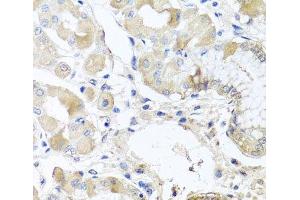 Immunohistochemistry of paraffin-embedded Human stomach using RPL36 Polyclonal Antibody at dilution of 1:100 (40x lens).