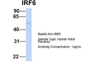 Host:  Rabbit  Target Name:  IRF6  Sample Type:  Human Adult Placenta  Antibody Dilution:  1.