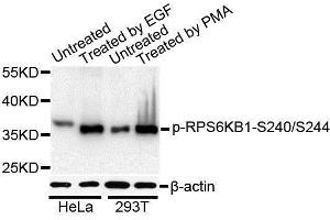Western blot analysis of extracts of HeLa and 293T cells, using Phospho-RPS6KB1-S240/244 antibody (ABIN5995797) at 1/1000 dilution. (RPS6 antibody  (pSer240, pSer244))