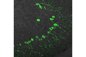 Immunostaining of paraffin embedded cerebellum section from rat (dilution 1 : 100). (ITPR1 antibody  (AA 2731-2749))
