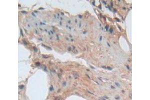 Figure. (ADAMTS5 antibody  (AA 267-622))