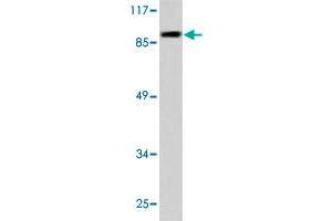 Western blot analysis of HeLa cell lysate treated with Etoposide 25uM 24h treated. (E2F1 antibody)