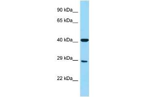 WB Suggested Anti-FCGR3A Antibody Titration: 1. (FCGR3A antibody  (Middle Region))