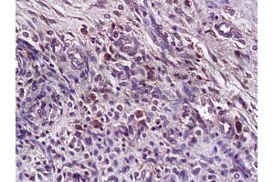 Formalin-fixed and paraffin embedded rat uterus tissue labeled with Anti-TRAILR1 Polyclonal Antibody (ABIN670581), Unconjugated at 1:200, followed by conjugation to the secondary antibody and DAB staining (DR4 antibody  (AA 401-468))