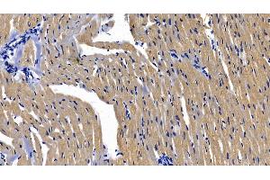 Detection of MyD88 in Rat Cardiac Muscle Tissue using Polyclonal Antibody to Myeloid Differentiation Factor 88 (MyD88) (MYD88 antibody  (AA 1-296))