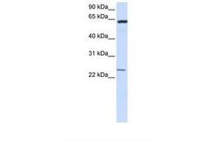 Image no. 1 for anti-Transmembrane Protein 138 (TMEM138) (N-Term) antibody (ABIN6738325)