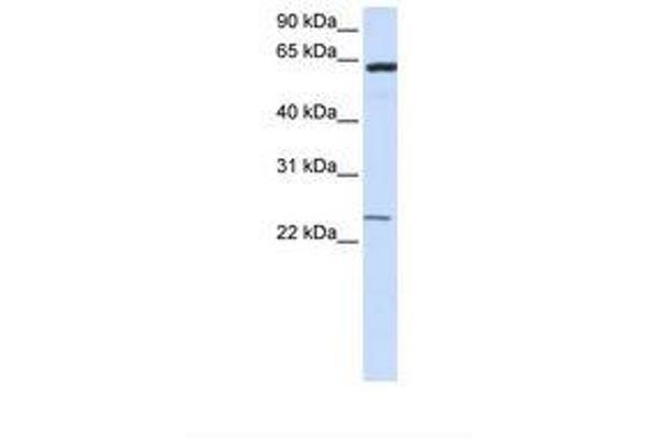 TMEM138 antibody  (N-Term)