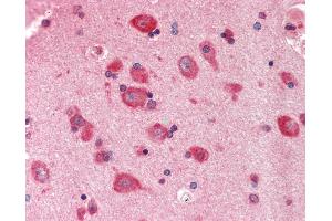 Anti-PYCR1 antibody IHC staining of human brain, cortex. (PYCR1 antibody  (AA 215-264))
