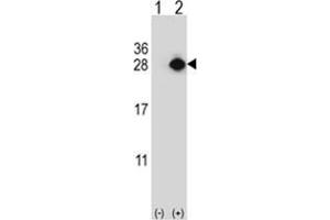 Western blot analysis of YEATS4 (arrow) using rabbit polyclonal YEATS4 Antibody . (GAS41 antibody)