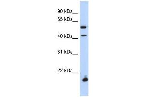 DBX1 antibody used at 0. (DBX1 antibody  (Middle Region))
