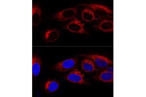 Confocal immunofluorescence analysis of U2OS cells using CK Polyclonal Antibody (ABIN6134474, ABIN6138645, ABIN6138646 and ABIN6223731) at dilution of 1:100. (CKAP4 antibody)