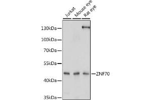 Western blot analysis of extracts of various cell lines, using ZNF70 antibody (ABIN7271522) at 1:1000 dilution. (ZNF70 antibody  (AA 1-140))