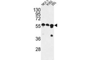 Western Blotting (WB) image for anti-CCR4-NOT Transcription Complex Subunit 4 (CNOT4) antibody (ABIN2998123)