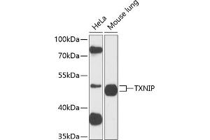 Western blot analysis of extracts of Rat uterus, using TXNIP antibody (ABIN6130776, ABIN6149733, ABIN6149734 and ABIN6224986) at 1:890 dilution. (TXNIP antibody  (AA 1-166))