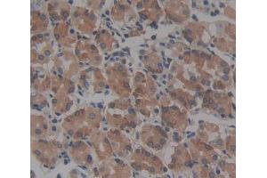 Used in DAB staining on fromalin fixed paraffin- embedded Kidney tissue (CBR1 antibody  (AA 2-277))