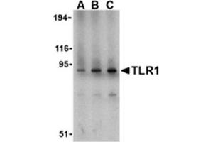 Image no. 1 for anti-Toll-Like Receptor 1 (TLR1) (N-Term) antibody (ABIN318756)