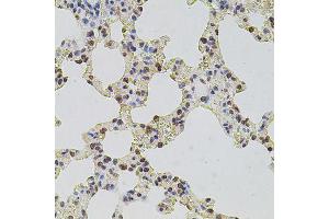 Immunohistochemistry of paraffin-embedded rat lung using HIST1H2AG antibody (ABIN6003627) at dilution of 1/100 (40x lens). (HIST1H2AG antibody)