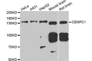 Western blot analysis of extracts of various cell lines, using CENPC antibody. (CENPC1 antibody)