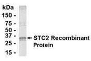 Western Blotting (WB) image for anti-Stanniocalcin 2 (STC2) (AA 20-302) antibody (ABIN2468046) (Stanniocalcin 2 antibody  (AA 20-302))