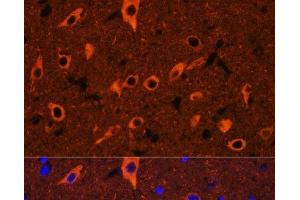 Immunofluorescence analysis of Rat brain using TUBB3 Polyclonal Antibody at dilution of 1:100. (TUBB3 antibody)