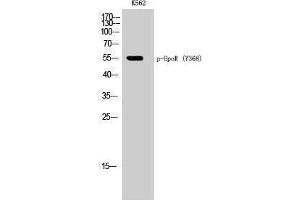 Western Blotting (WB) image for anti-Erythropoietin Receptor (EPOR) (pTyr368) antibody (ABIN3182440) (EPOR antibody  (pTyr368))