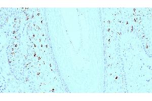 Human skin: immunohistochemical staining for langerin. (CD207 antibody)