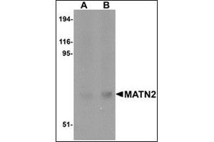 Western blot analysis of MATN2 in human liver tissue lysate with this product at (A) 1 and (B) 2 μg/ml.