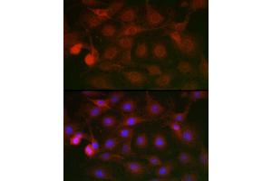 Immunofluorescence analysis of C6 cells using SSR2 Rabbit pAb (ABIN7270299) at dilution of 1:100 (40x lens). (SSR2 antibody)