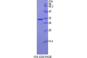 SDS-PAGE analysis of Rat Hyaluronan Synthase 1 Protein.