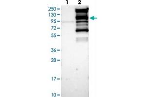 Western blot analysis of Lane 1: Negative control (vector only transfected HEK293T lysate), Lane 2: Over-expression Lysate (Co-expressed with a C-terminal myc-DDK tag (~3. (WDR44 antibody)