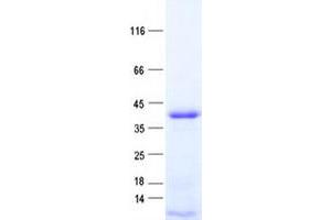 Validation with Western Blot (PHF11 Protein (His tag))