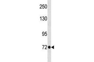 TBR2 antibody western blot analysis in A375 lysate. (EOMES antibody  (AA 28-57))
