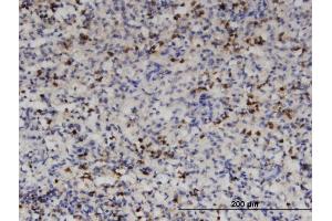 Immunoperoxidase of monoclonal antibody to HDAC4 on formalin-fixed paraffin-embedded human spleen. (HDAC4 antibody  (AA 551-648))