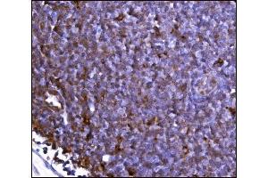 IHC analysis of FABP-1/GOT2 using anti-FABP-1/GOT2 antibody (ABIN7601426). (GOT2 antibody  (AA 35-430))