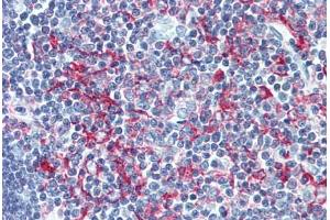 Human Thymus (formalin-fixed, paraffin-embedded) stained with LSP1 antibody ABIN305891 at 1:100 followed by biotinylated goat anti-rabbit IgG secondary antibody ABIN481713, alkaline phosphatase-streptavidin and chromogen. (LSP1 antibody  (AA 37-48))