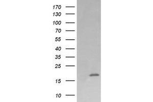 Image no. 5 for anti-Cancer/testis Antigen 1B (CTAG1B) antibody (ABIN1499906) (CTAG1B antibody)