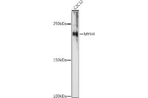 Western blot analysis of extracts of C2C12 cells, using MYH4 antibody (ABIN7268749) at 1:1000 dilution. (MYH4 antibody  (AA 1450-1550))
