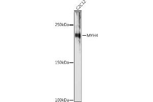 Western blot analysis of extracts of C2C12 cells, using MYH4 antibody (ABIN7268749) at 1:1000 dilution. (MYH4 antibody  (AA 1450-1550))