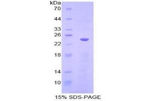 SDS-PAGE analysis of Mouse Cadherin 5 Protein. (Cadherin 5 Protein (CDH5))