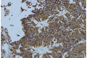 ABIN6276530 at 1/100 staining Mouse testis tissue by IHC-P. (Cardiac Troponin T2 antibody  (C-Term))