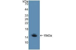 Detection of Recombinant LRP1, Human using Polyclonal Antibody to Low Density Lipoprotein Receptor Related Protein 1 (LRP1) (LRP1 antibody  (AA 4441-4544))