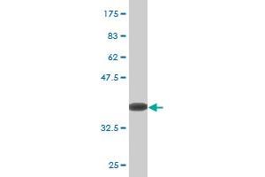 Western Blot detection against Immunogen (36. (ZBTB16 antibody  (AA 381-480))