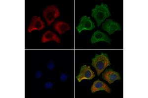 ABIN7094204 and ABIN7098250 staining HepG2 cells by IF/ICC. (ERO1L antibody  (Internal Region))