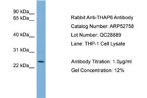 WB Suggested Anti-THAP6  Antibody Titration: 0. (THAP6 antibody  (Middle Region))