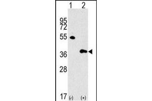 Western blot analysis of GBL Antibody (Center) polyclonal antibody (ABIN392823 and ABIN2842254) (arrow). (GBL antibody  (AA 140-170))